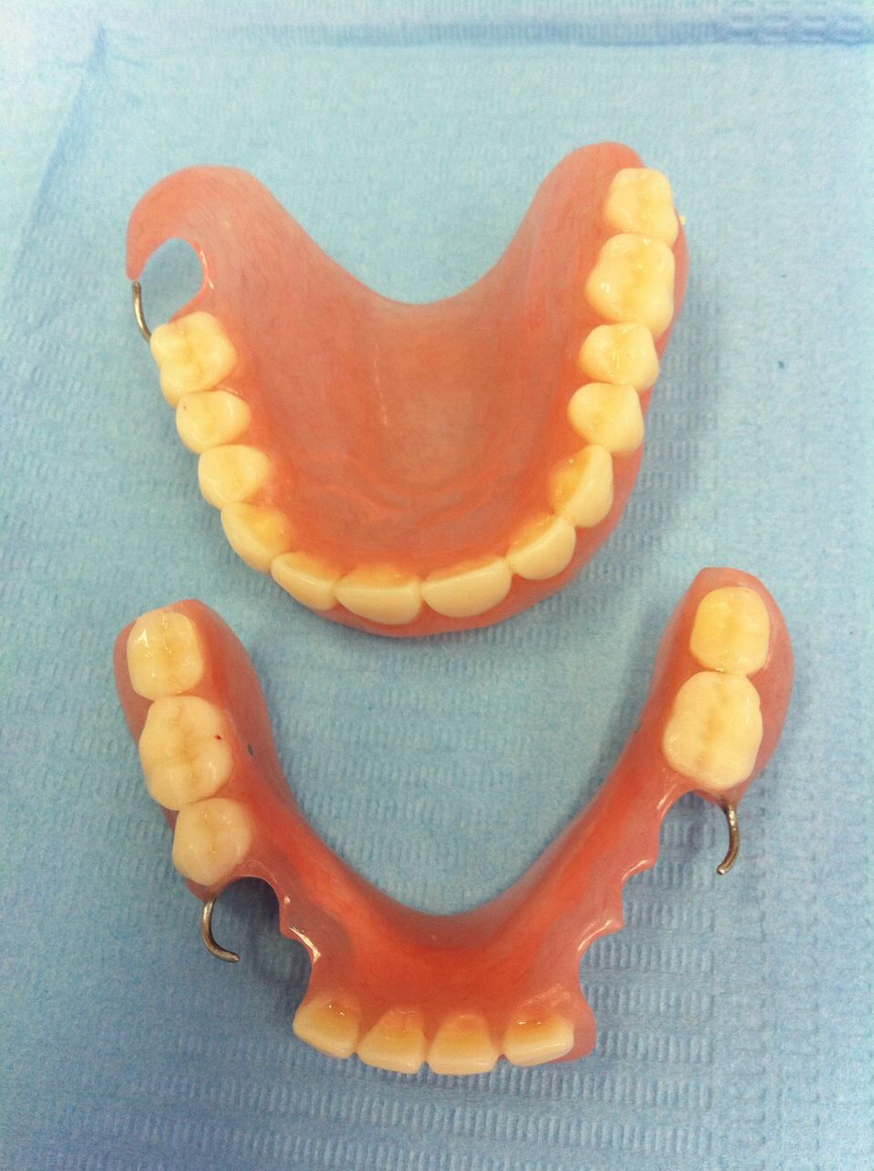 Какие зубные протезы лучше при отсутствии зубов. Микропротез Квадротти. Пластинчатый микропротез. Пластиночный протез на верхнюю челюсть. Съемный пластиночный протез на верхней челюсти.