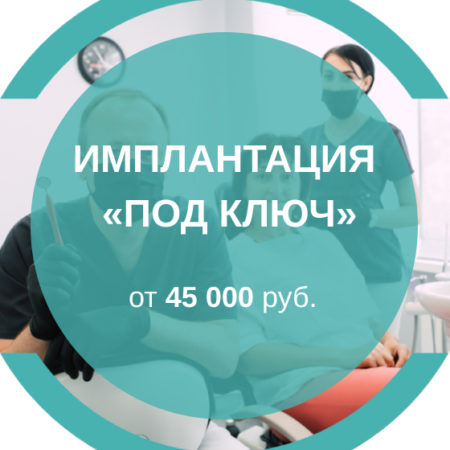Имплантация «под ключ»